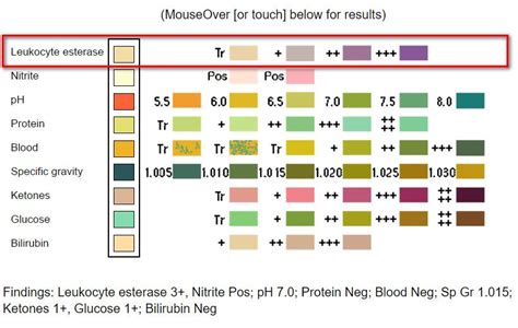 Leukocytes in Urine: Normal Range and High Levels .